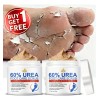 Crema Exfoliante Para Pies Con Urea 60% Y Ácido Salicílico