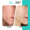 Suu Balm - Gentle Moisturising Facial Cleanser - Eczema, Psoriasis,