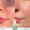Ren Clean Skincare - Elixir De Soporte De Barrera Evercalm