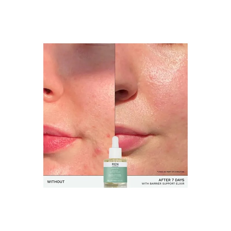 Ren Clean Skincare - Elixir De Soporte De Barrera Evercalm