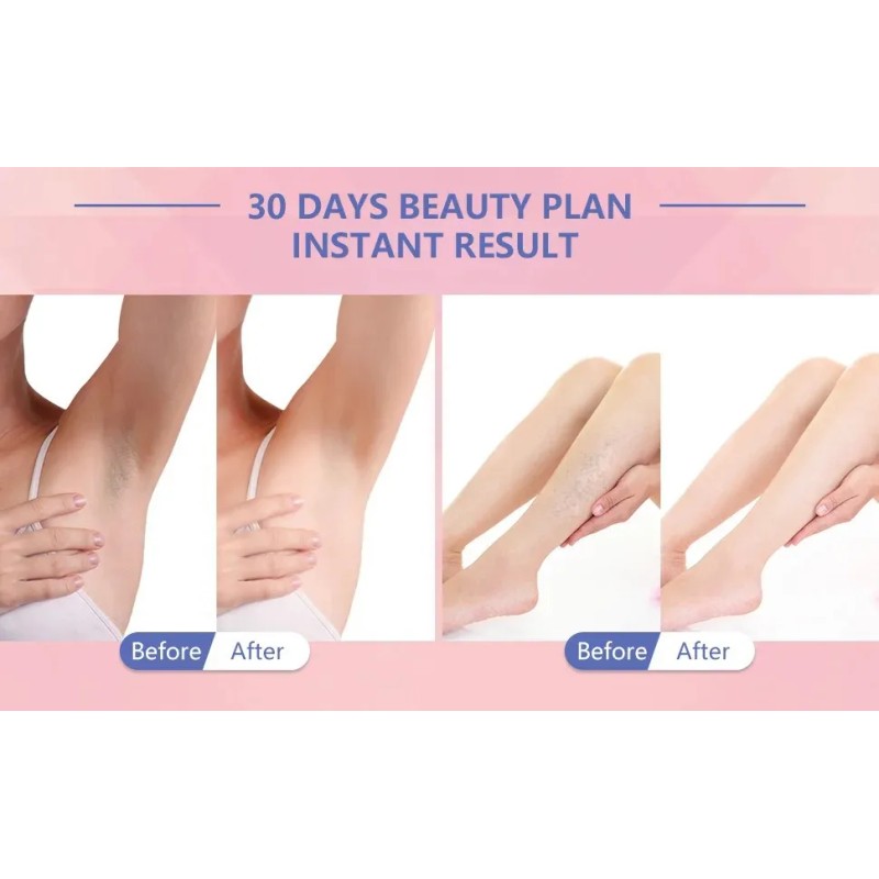 Crema Blanqueadora Aclara Cuerpo Zonas Intimas Cuello Codos Neutra