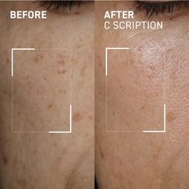 Dr. Brandt Bright This Way C Scription - Concentrated Vitamin C Serum - Fade Dark Spots, Reduce Wrinkles & Illuminate Skin Tone - 30 mL