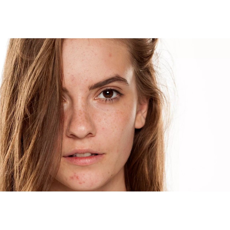 A3 Lemon Face Cream | Brightening & Control Stubborn Blemishes|400