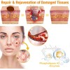 , Crema De Tratamiento, Crema Profesional Para El