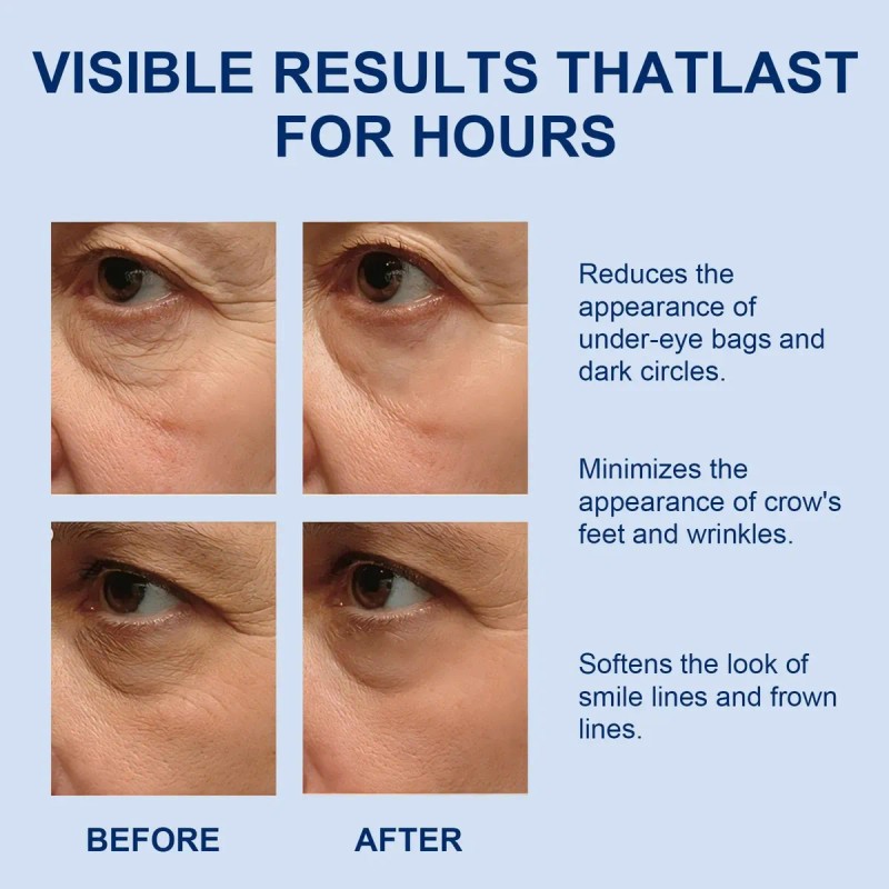 Under-eye Bags & Wrinkles Rapid-reduction Serum & Instant