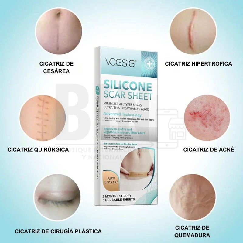Hojas De Silicona Ayuda A Eliminar Cicatrices Acné Queloide