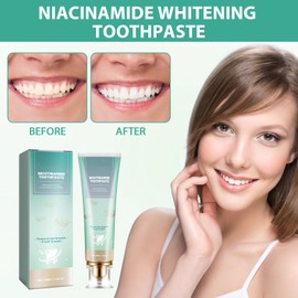 Radiant Whitening Zahnpasta, Mildes Zahncreme Weiße Zähne, Frisches Niacinamide Zahnpasta, Fördert die Mundfrische, Tiefenreinigung, Grün, mit 1 Zahnbürste
