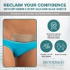 Epiderm Silicone Gel Scar Sheets - Premium-Grade Silicone Scar Sheets