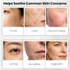 Ice Globes for Face & Eyes, Stainless Steel Facial Lifting