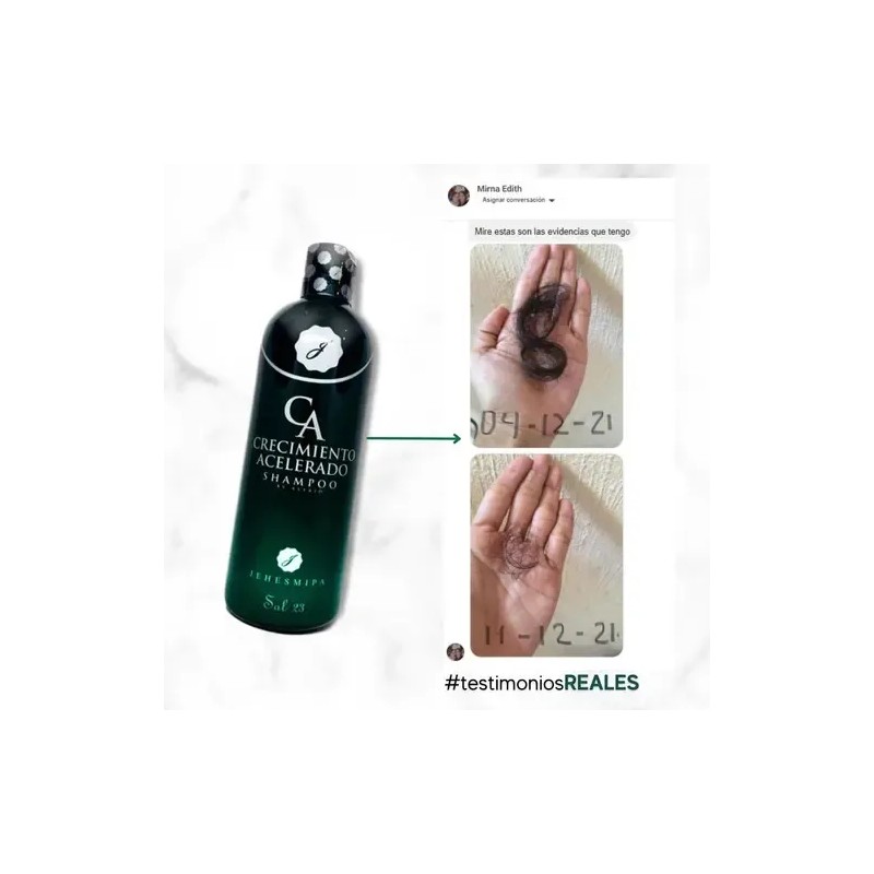 3 Shampoo Crecimiento Acelerado Jehesmipa Producto Original