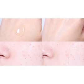 Acnes Dermarelief Balancing Skin, 200ml, 1 piece