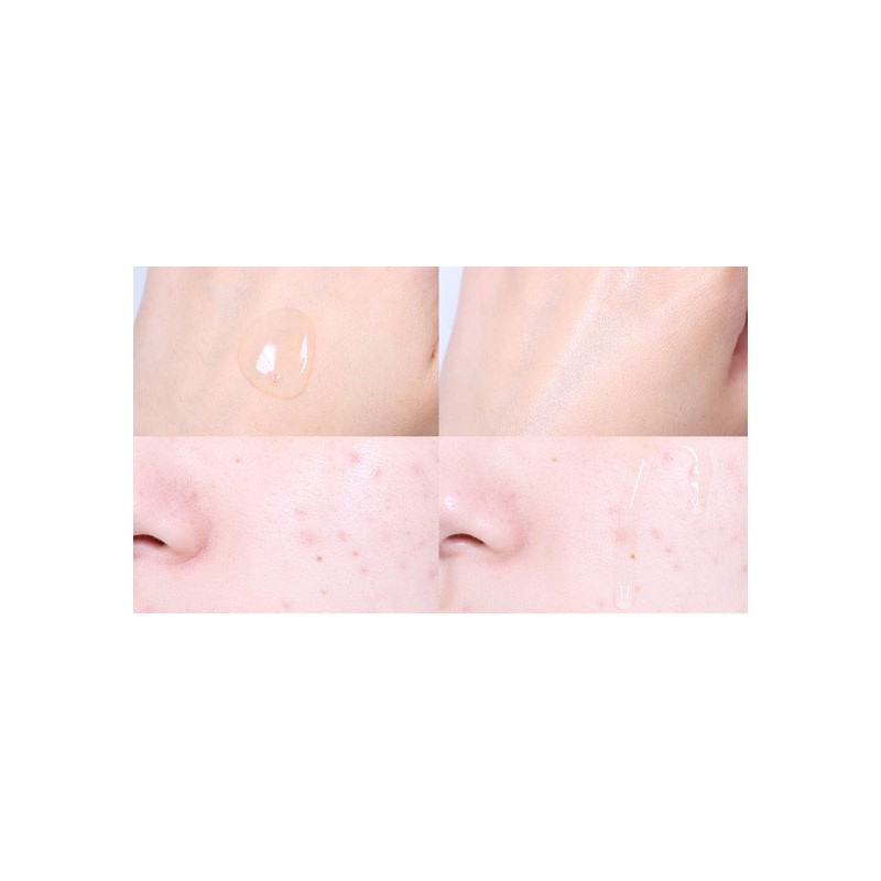 Acnes Dermarelief Balancing Skin, 200ml, 1 piece
