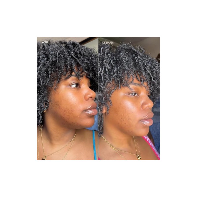 DERMISA CREMA PARA MANCHAS CON VITAMINA C Y EXTRACTO DE