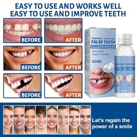 2PCS Temporary Tooth Repair Kits,Repair Beads Tooth Filling Repair Kit,Moldable False Teeth for Fixing,Thermal Forming Filling Kit for Teeth,Den/tal Repair Beads for Fixing,Den/tal Repair Kit Filling
