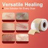 Silicone Scar Sheets (1.6”x 60” Roll-1.5M), Medical Grade Silicone Scar