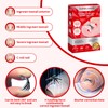 Upgraded Titanium Alloy Ingrown Toenail Corrector with Upgraded 6-Angle Shape,3x