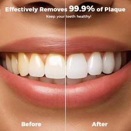 Water Flossers for Teeth, Water Picks for Teeth Cleaning & Flossing, 180ML Mini Collapsible Portable Waterproof Electric Water Dental Flosser for Travel Business, 3 Modes and 4 Jet Tips, Light Blue