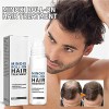 Mz Hace Crecer La Barba Y El Cabello, Original, 18