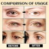 Crema Para Ojos, Crema Hidratante En Barra Para Ojos, Borra