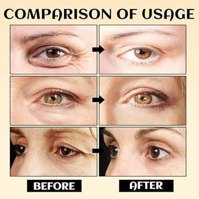 Crema Para Ojos, Crema Hidratante En Barra Para Ojos, Borra