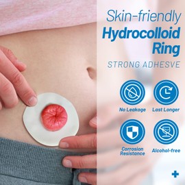 Heagimed 10Pcs 2mm Moldable Ostomy Rings, Hydrocolloid Stoma Barrier Rings for Colostomy Bags, Sting-Free, Box of 10
