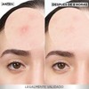 Garnier Pimple Patch Invisible, Parches Hidrocoloides Para Acné, Reduce Imperfecciones