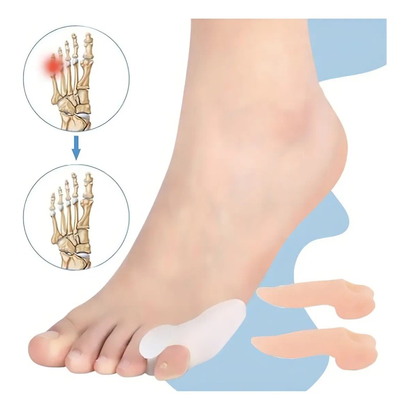 Separador de Juanete Meñique Gel Silicona Unitalla Blanco 1 Par