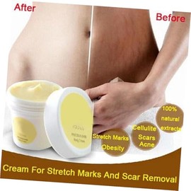 PLAFOPE 2 Piezas Eliminación De Cicatrices Tratamiento De Estrias Crema Para Cicatrices Crema De Estrías Eliminación De Estrías
