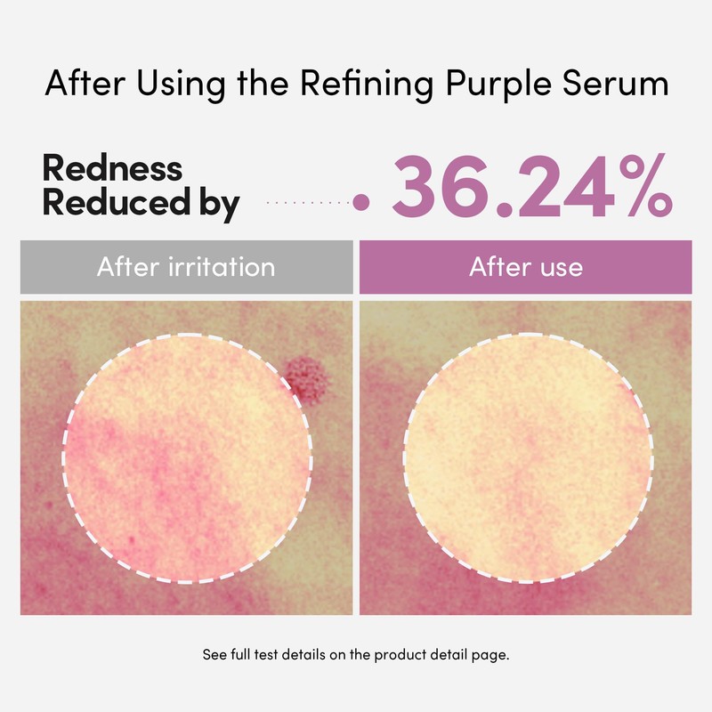 LAGOM Cellus Refining Purple Serum, 10% Azelaic Acid, Ceramide&Panthenol, Herb