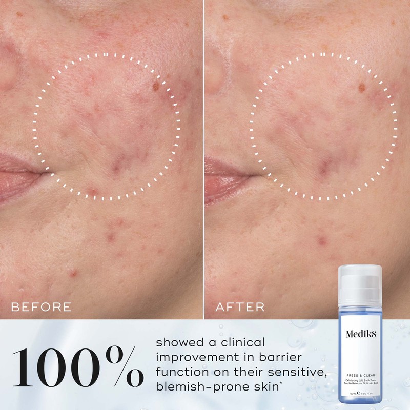 Medik8 Press and Clear 150ml