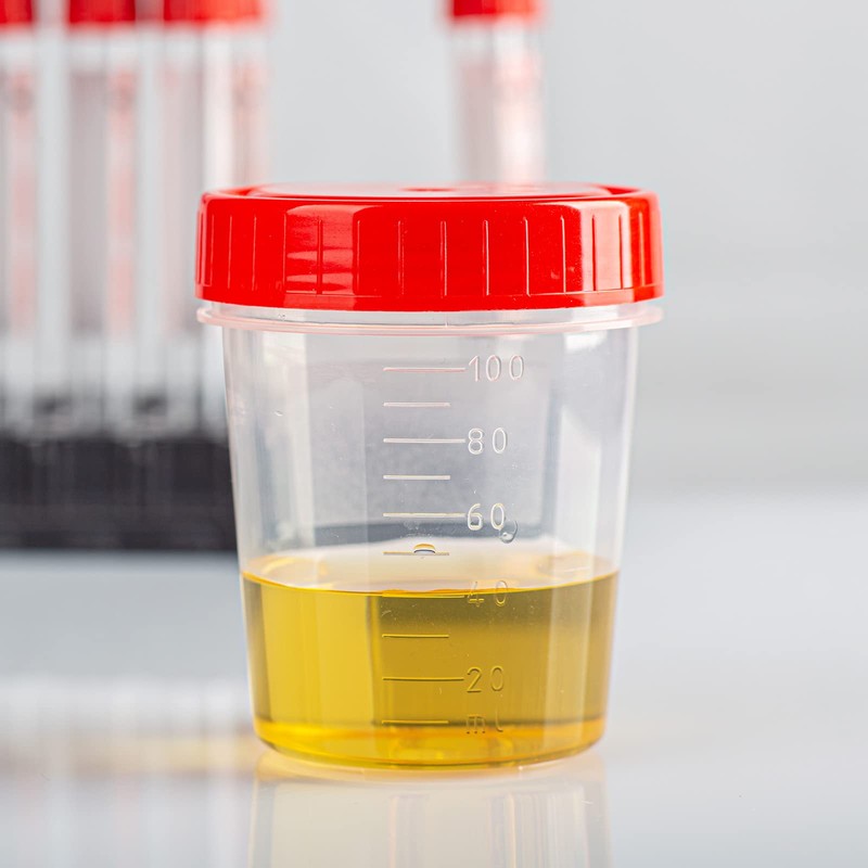 PATIKIL 120mL Sample Cups, 5 Pack Sample Containers Leak Proof