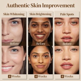 Klyssa 3.5 ounces*2 Organic Turmeric Kojic Acid Soap Bars- Brighten Skin & Fade Dark Spots | Hydrating & Gentle Care | Antioxidant Protection | Sustainable & Handmade 100g 2 pack