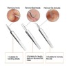 Blackhead Remover Kit - FEITA Blackhead Tweezers Removal Tool Kit