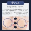 大容量 ニキビ 薬 跡 【医薬部外品ｘ薬用アクネジェルｘdimpｘ保湿ｘ抗炎症ｘ殺菌​トリプル処方ｘジェルｘメンズｘレディースｘ思春期ｘ大人男性ｘ大人女性ｘ毛穴ケアｘにきび予防ｘニキビ跡】１００ｇｘさわやかハスの香り