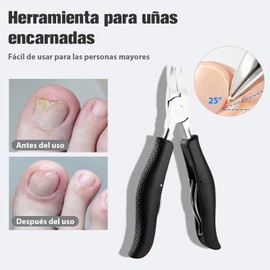 BTOOTB 16 Pcs Kit De Herramientas Cortauñas, Acero Inoxidable Uñas Encarnadas Cortauñas Alicates, kit de pedicura para pies, Cortaúñas grueso para personas mayores, kit podologia profesional, pedicure kit (16 PCS)