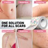 Silicone Scar Tape for Surgical Scars, Silicone Scar Sheets, C