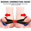 FERCAISH Pack of 2 Hallux Valgus Band Corrector, Bunion Toe