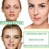 10 Pack Sheet Face Mask Set,Moisturizing Long Lasting Facial Sheet