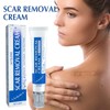 Scar Cream - Hydrating & Moisturizing Skin Care for Women