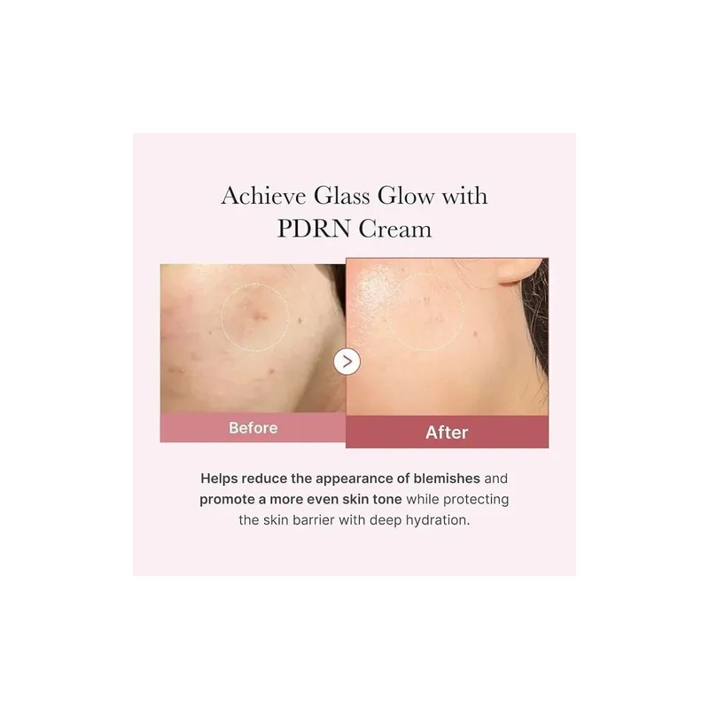 Kit Medicube Pdrn Adn De Salmón Skincare Set De 5
