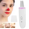 Ultrasonic Skin Scrubber Blackhead Removal Pore Cleaning Face Spatula for