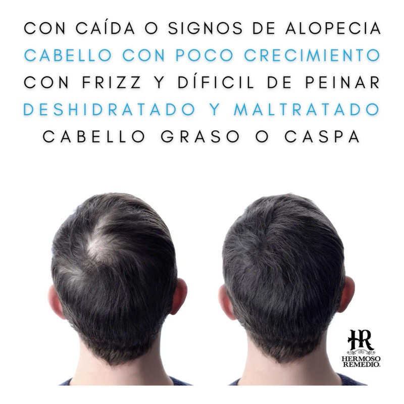 Shampoo Hermoso Remedio anticaida crecimiento acelerado reparador hidratante anticaspa para