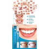 Teeth Whitening Pen - Fast, Easy and Travel-Friendly | Instant