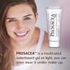 Prosacea Rosacea Treatment Gel, 0.75 Ounce Tubes (Pack of 2)