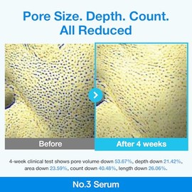 numbuzin No.3 Serum | Blue Retinol Pore Refining Serum | Pore Tightening, Firming, Anti-Aging, Korean Skincare | Niacinamide, Peptide, Salicylic Acid 