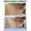 Roc Even Tone & Lift Hidratante Fps 30 + Crema