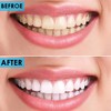 Candure Professional Dental Probes for Cleaning Stainless Steel Teeth Whitening