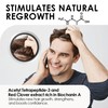 ThickTails Men's Root Stimulating Leave-In Serum, 100ml: Combat Hair Breakage,