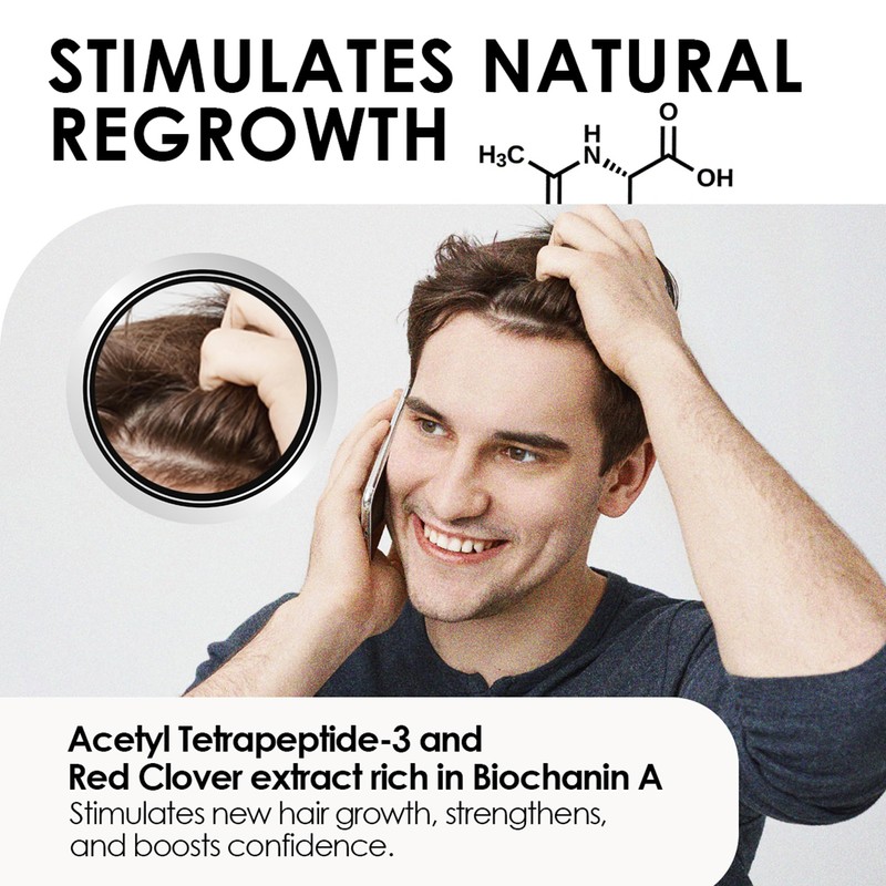 ThickTails Men's Root Stimulating Leave-In Serum, 100ml: Combat Hair Breakage,