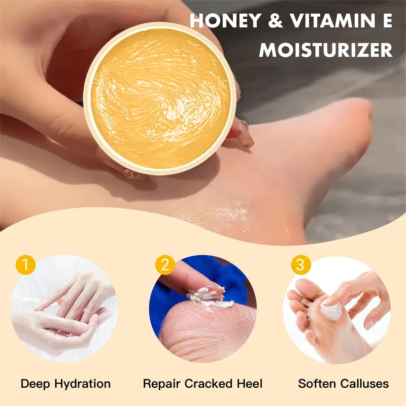 Foot Cream – Honey & Vitamin E Moisturizer, Cracked Heel